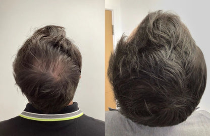 FEG Plus 👉( Men & women ) Hair Growth Spray ✅100% Original