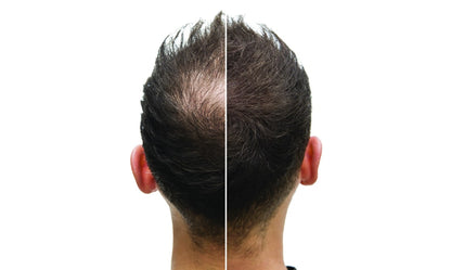 FEG Plus 👉( Men & women ) Hair Growth Spray ✅100% Original